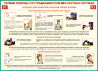 Таблица Порядок действий при опасном кровотечении 1000*1400 винил - «globural.ru» - Нижняя Тура